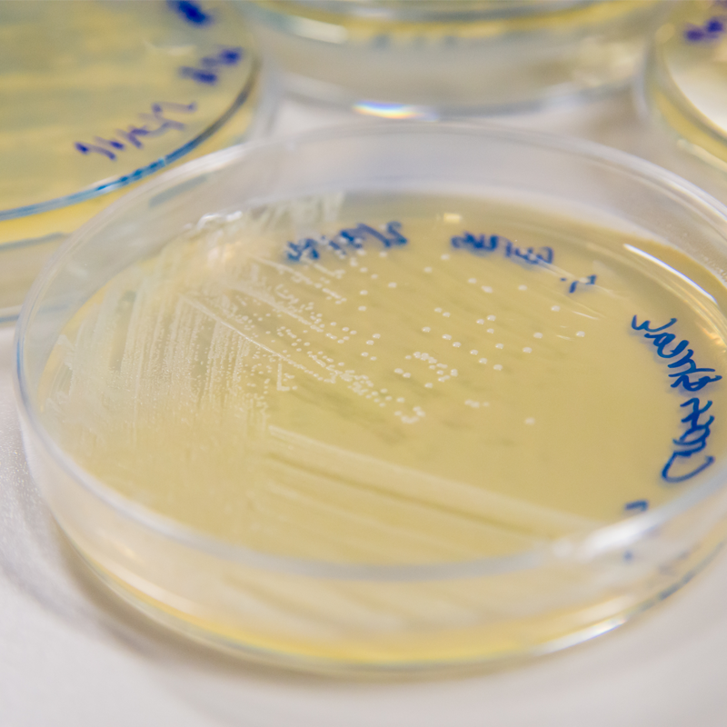 MRSA bacterie in een kweek bakje