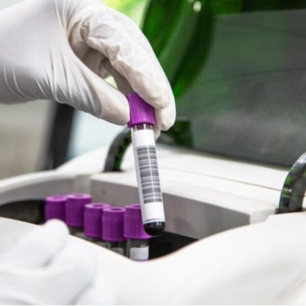 gehandschoende hand pakt laboratoriumbuisje met barcode